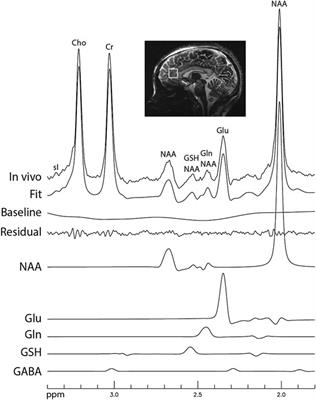 Roles of Strong Scalar Couplings in Maximizing Glutamate, Glutamine and Glutathione Pseudo Singlets at 7 Tesla